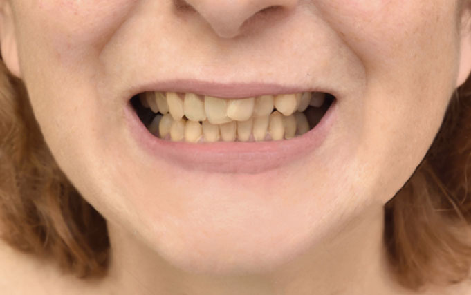 before-treatment